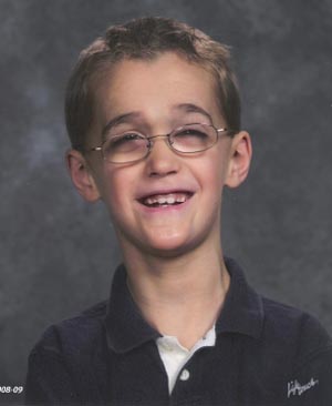 Soto_Syndrome (1).jpg